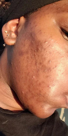 Priya S. - Day 1
